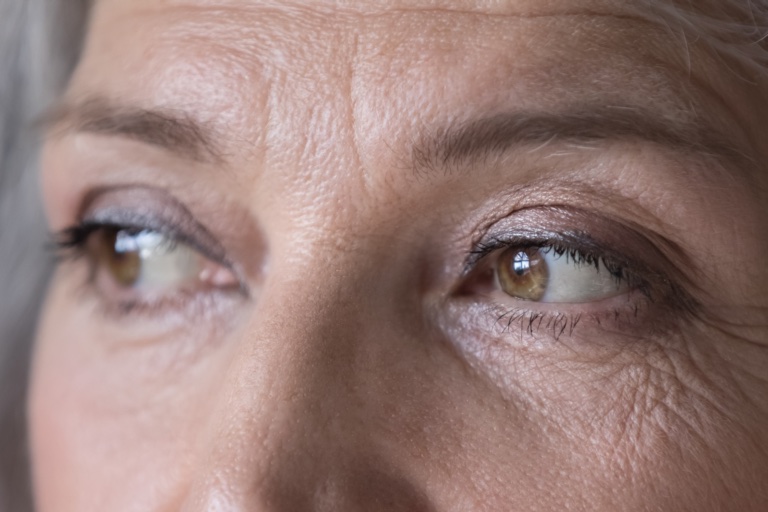 Woman Aging Eyes